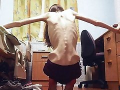 Anorexia nervosa pictures with skinny women and girls
